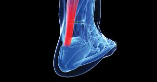 By strengthening the achilles tendon in the same manner as a running or sprinting motion, you will help prevent the achilles injury from coming back. Racgp The Achilles Tendon