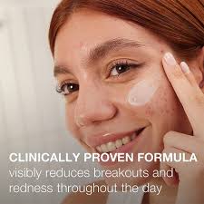 نيتروجينا، كريم نهاري معالج لحب الشباب المستعصي