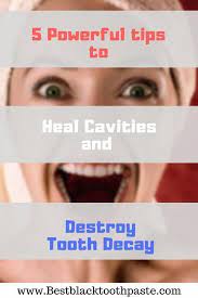 Pin On What Does Oral Care Mean