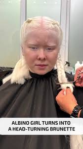 Brunette transformation for albino girl