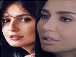 حلا شيحة تهاجم تامر حسني. Ø®Ø§Øµ Ø¨Ø¹Ø¯ ØªØµØ¯Ø±Ù‡Ø§ Ø§Ù„ØªØ±ÙŠÙ†Ø¯ Ø­Ù„Ø§ Ø´ÙŠØ­Ø© Ù†Ø§Ø¯Ù…Ø© Ø¹Ù„Ù‰ Ø¹Ù…Ù„ÙŠØ§Øª Ø§Ù„ØªØ¬Ù…ÙŠÙ„ Ø¨ÙˆØ§Ø¨Ø© Ø£Ø®Ø¨Ø§Ø± Ø§Ù„ÙŠÙˆÙ… Ø§Ù„Ø¥Ù„ÙƒØªØ±ÙˆÙ†ÙŠØ©