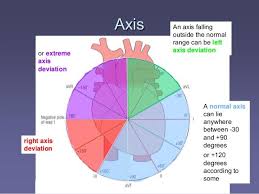 determining right or left axis deviation cardiology