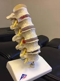 • hvorfor vi får vondt i ryggen • hvordan ryggen er bygget opp • hvilke forandringer som skjer med årene den består av 7 virvler i nakken, 12 i brystdelen og 5 i korsryggen. Artrose Kiropraktisk Senteret Stavanger