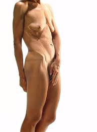Anorexia nackt