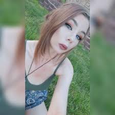 Amy Schumer says she wouldn't have known she had Cushing syndrome if it  weren't for Internet trolls.