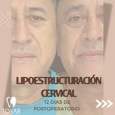 TovarDent (@tovardental_esthetic) · Quevedo