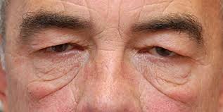 Get enough sleep.for most adults, seven to nine hours is a good amount of sleep. Under Eye Bags In Men What Can Men Do To Hide Under Eye Bags