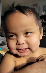 Im sorry for no update. I put it in the wrong place. He is home and doing  fine. It turned out that his feeding tube was out of place. The balloon that