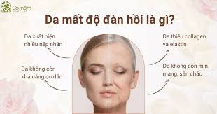 Da mất độ đàn hồi là gì? Tips cải thiện độ đàn hồi của da