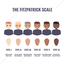Image result for Fitzpatrick Skin Type