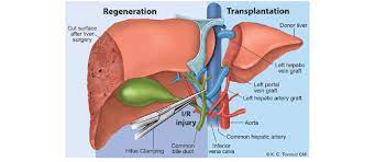 This diagram depicts location of liver in human anatomy. Liver Iri Regeneration And Transplantation The Figure Represents An Download Scientific Diagram