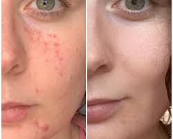 The Biggers The Better