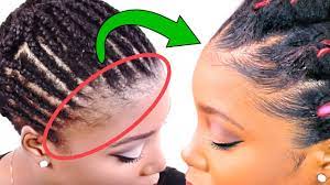 If you can't give up the wigs and weaves, make sure you use some kind of oil on your edges every night in addition to moisturizing and sealing the rest of your hair. How To Grow Your Edges Back Before After Results Youtube