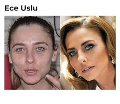 Ancak ece seçkin, demet akalın'ı asla sallamadı ve ona yorum yapan takipçisine cevap verdi. Bengu Makyajsiz Hali