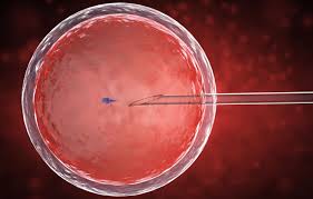 Il esistono diversi metodi utilizzati per ottenere lo sperma necessario per l'inseminazione artificiale. Fecondazione Assistita Come Avviene Quanto Costa Le Tecniche E Le Leggi In Italia