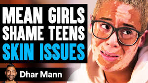 MEAN GIRLS Shame TEEN'S SKIN ISSUES, What Happens Next Is Shocking