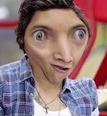 نتیجه جستجوی لغت [widened] در گوگل