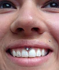 Lippenbaendchen Lippenbandchen Smileypiercing Piercing Janeabsinth Livingillustrations Dusseldorf Tat Smiley Piercing Piercings Ear Conch Ear Piercings