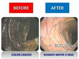 Salah satu reaksi yang dimaksud dalam di sini adalah payudara terasa gatal. Kangen Water Sragen 54 Photos Health Beauty Tanon Sragen Jln Tanon Pungkruk Sragen Jateng