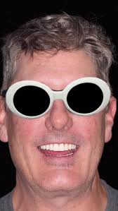 ✨ Witness the Transformation! ✨, Check out this incredible journey of one  of our patients! Our advanced technology and specialist care turned their  smile into a life-changing masterpiece. 🦷✨, At Smile ...