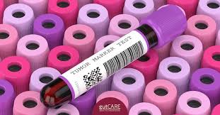 Tumour markers are substances that are made by cancer cells or by normal cells in response to cancer. Understanding Raised Cancer Markers Should You Worry