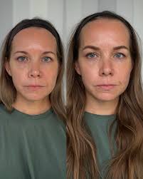 Building a fuller brow,