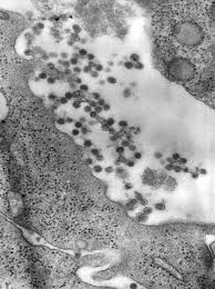 Image result for Xyris rubella