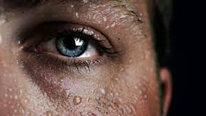 asiri terleme hiperhidroz hemen saglik