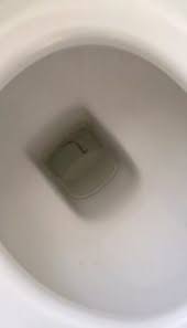 Check spelling or type a new query. Worm In Toilet No Cause For Alarm All About Worms