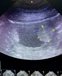 Recent studies have revealed the presence of lesions in both the bladder and the urethra. Canine Bladder Tumors Metro Paws Animal Hospital