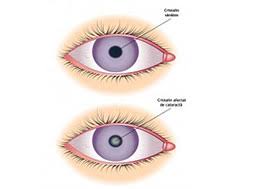 Spitalul de oftalmologie, spitalul de ochi west eye hospital bucuresti. Spitalul De Oftalmologie Spitalul De Ochi Westeye Bucuresti