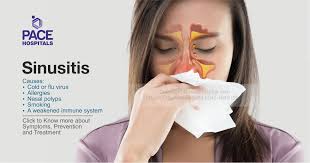 It may be done in combination with other the surgery is performed through your nostrils. Sinusitis Types Causes Symptoms And Treatment