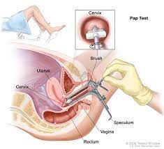 Definition Of Internal Exam Nci Dictionary Of Cancer Terms National Cancer Institute