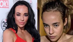 Stephanie Davis recalls 'dark place' as she admits alcohol addiction  recovery