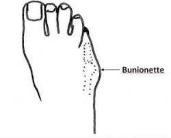Pin On Foot Pies