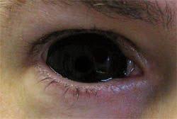 Black And White Sclera Contacts Pin On Sclera Contacts