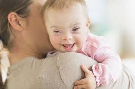 Image result for down syndrome baby