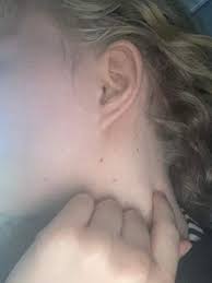 Knubbel Die Meistgelesenen Fragen