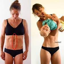Diastasis Recti Ab Exercises Abdominal Separation Workouts