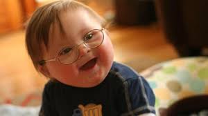 Yargıtay'dan down sendromu kararı! Doktorlar ailelere tazminat ödeyebilir