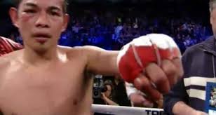 Mets pitcher Blackburn's performance and injury concerns