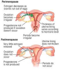 Here are the main risk factors for if you haven't gone through menopause yet, you'll stop having menstrual periods after surgery, and you. Menopause And Perimenopause Guide Causes Symptoms And Treatment Options