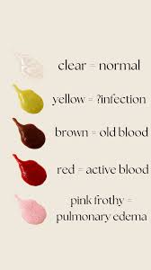 Image result for Sputum