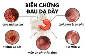 Mar 04, 2017 · in addition to the motor symptoms parkinson's disease (pd) is known for, the condition can also cause symptoms in the gastrointestinal and urinary systems. Táº¥t Cáº£ Nhá»¯ng Ä'iá»u Cáº§n Biáº¿t Vá» Bá»‡nh Ä'au Dáº¡ Day