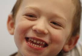 Baby teeth: When should you introduce your child to the dentist?