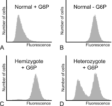 Image result for G6PD Deficiency Detection