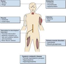 Image result for Myopathy
