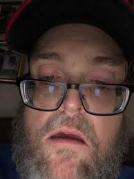 Halpern Paul D OD, 544 Haws Ave, Norristown, PA 19401, US