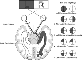 Deficits In Visuospatial Visuoconstructional Skills And