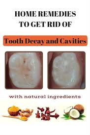 Home Remedies To Get Rid Of Tooth Decay And Cavities Amazingbeautytips Tooth Decay Remedies Dental Decay Tooth Decay